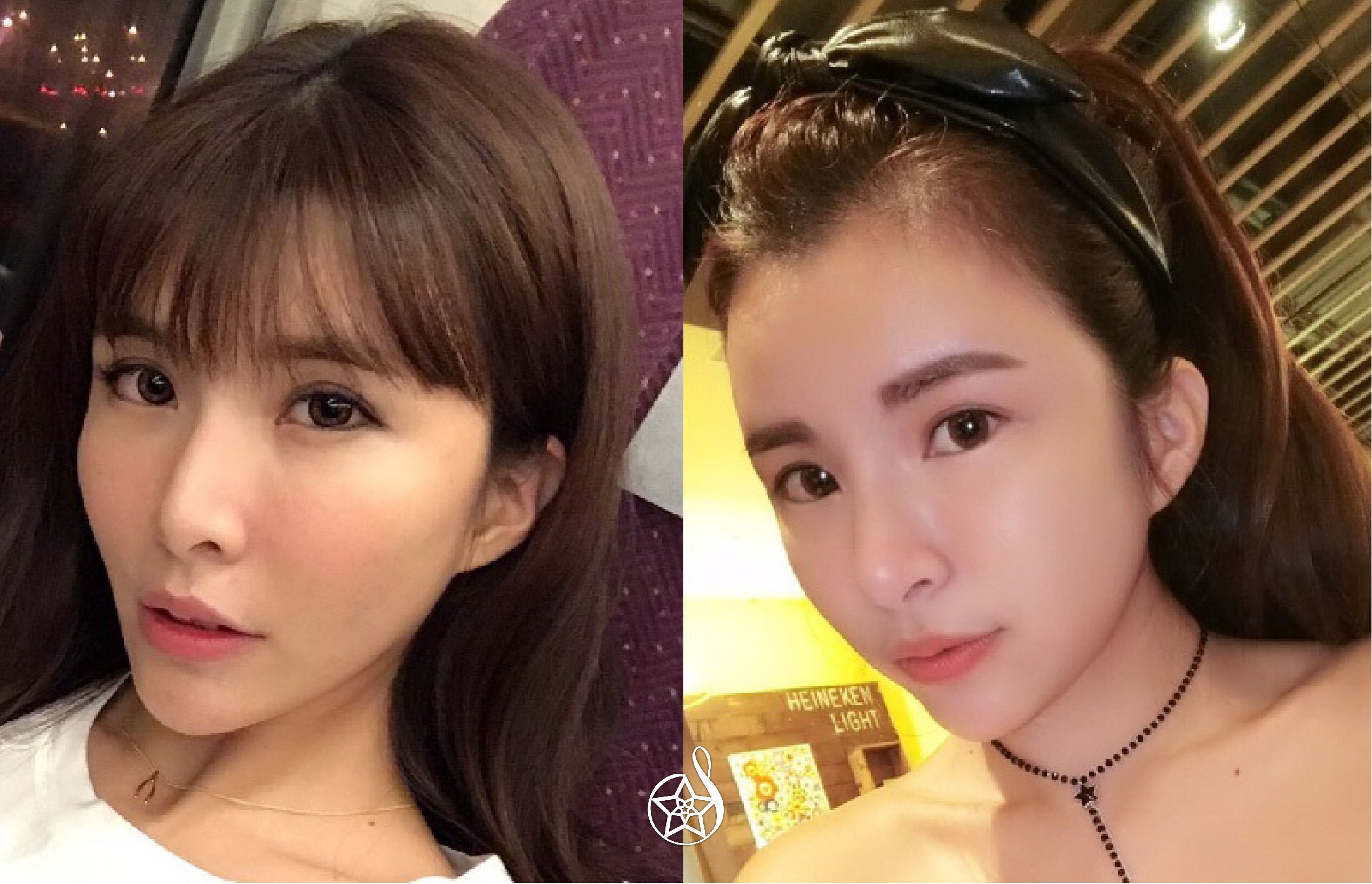 ELLANSE洢蓮絲改寫肌膚老化命運，一次滿足填補凹陷、塑形、回到少女時代三重願望！
